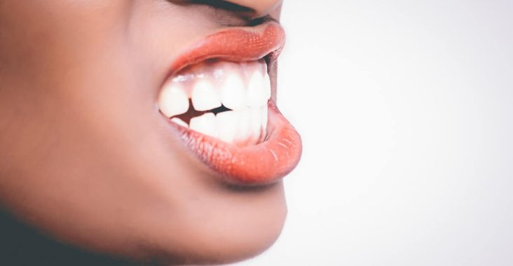 Odsłonięte szyjki zębowe - jak leczyć