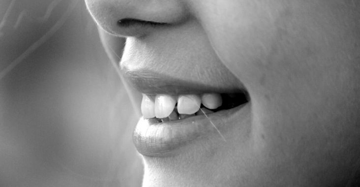 Aparat ortodontyczny - wyciągi - rodzaje