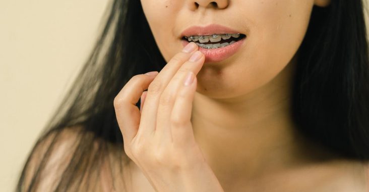 Nieprzyjemny zapach z ust - halitoza